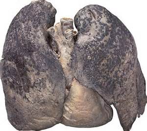 Легкие курильщика не могут доставлять кислород к тканям